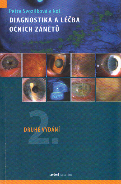 Diagnostika a léčba očních zánětů