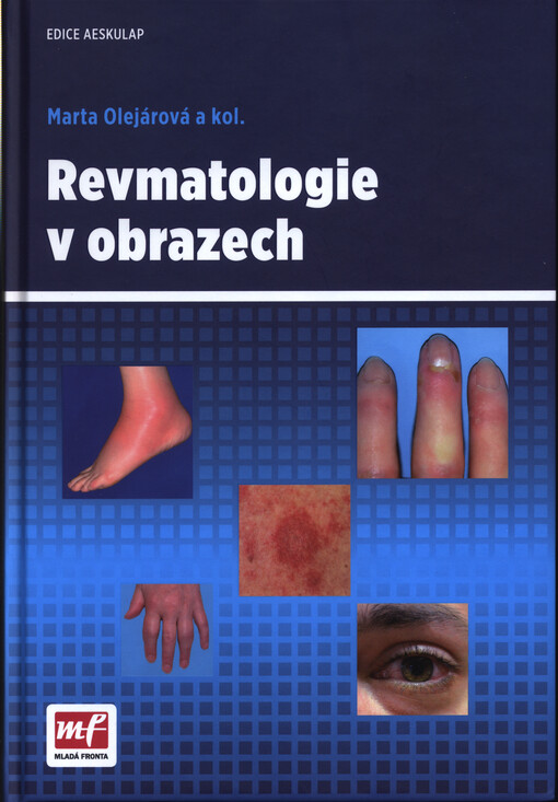Revmatologie v obrazech