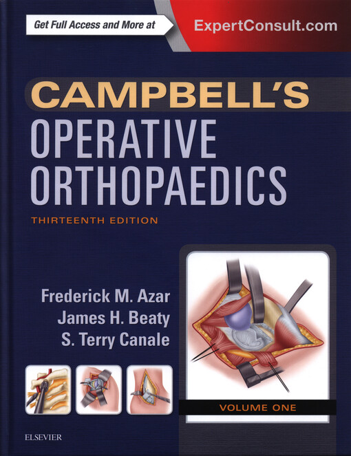 Campbell's Operative Orthopaedics