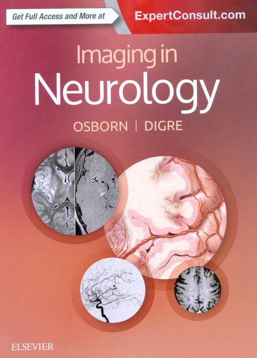 Imaging in neurology