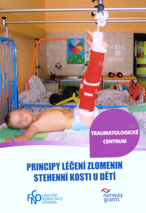 Principy léčení zlomenin stehenní kosti u dětí