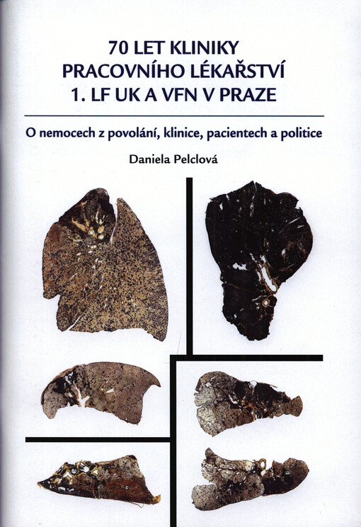 70 let Kliniky pracovního lékařství 1. LF UK a VFN v Praze : o nemocech z povolání, klinice, pacientech a politice