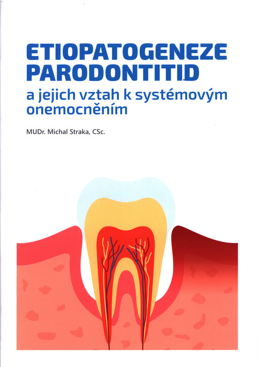 Etiopatogeneze parodontitid a jejich vztah k systémovým onemocněním