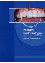 Dentální implantologie  (odkaz v elektronickém katalogu)