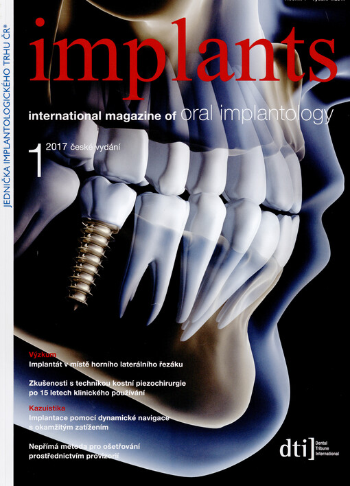 Implants : international magazine of oral implantology : české vydání