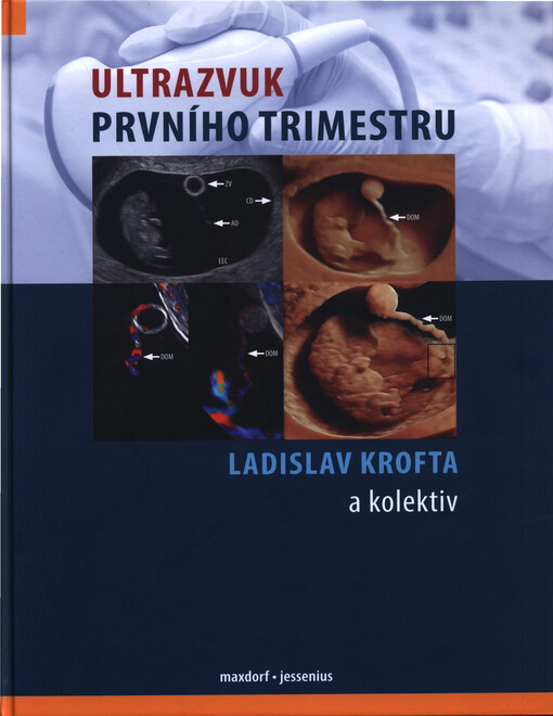 Ultrazvuk prvního trimestru