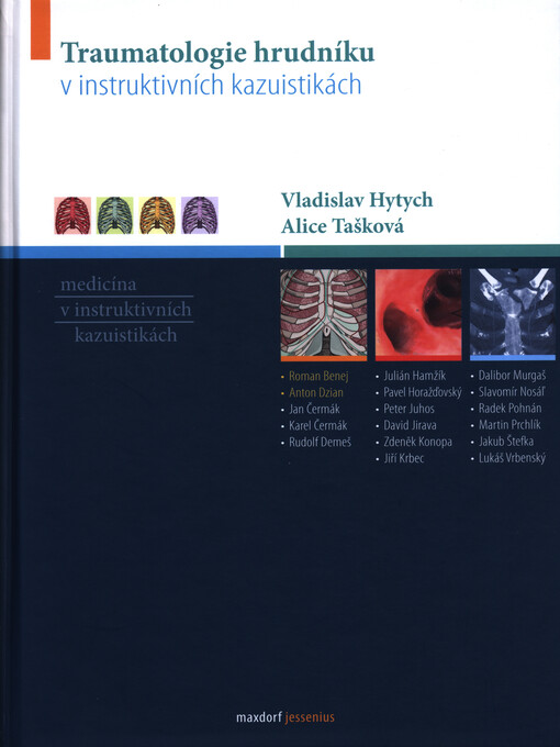Traumatologie hrudníku v instruktivních kazuistikách