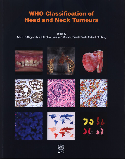 WHO Classification of Head and Neck Tumours