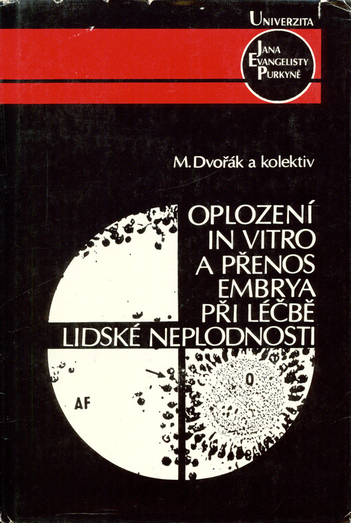 Oplození in vitro a přenos embrya při léčbě lidské neplodnosti =Fertilization in vitro and embryo transfer in the treatment of human infertility