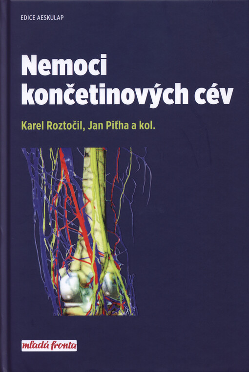 Nemoci končetinových cév