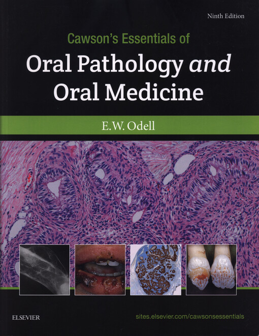 Cawson's Essentials of Oral Pathology and Oral Medicine