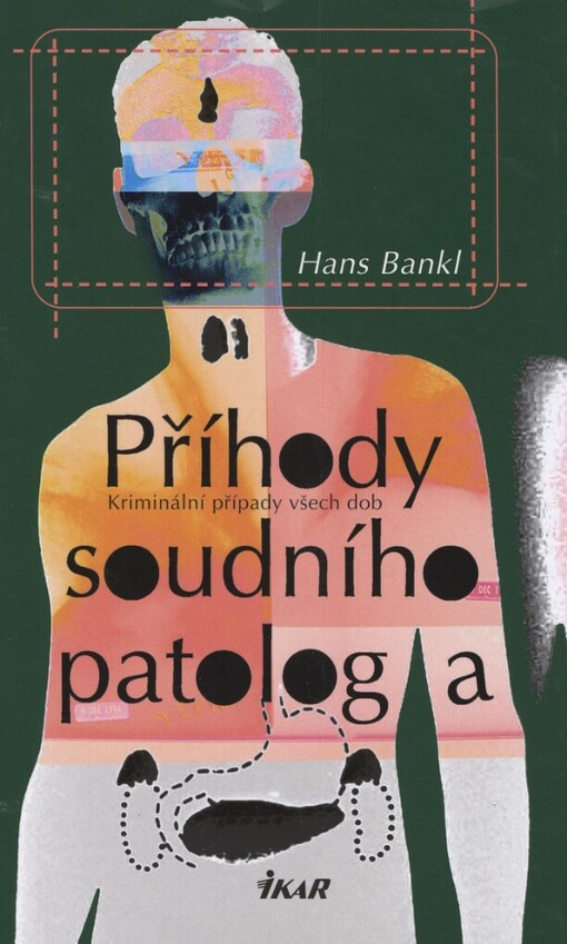 Příhody soudního patologa: kriminální případy všech dob