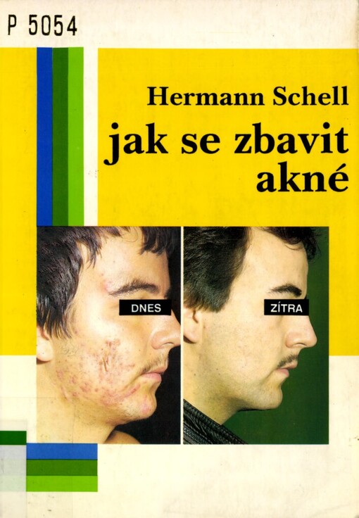 Jak se zbavit akné