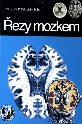 Řezy mozkem :neuroanatomie, CT, NMR