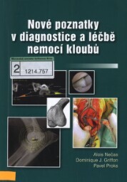 Nové poznatky v diagnostice a léčbě nemocí kloubů