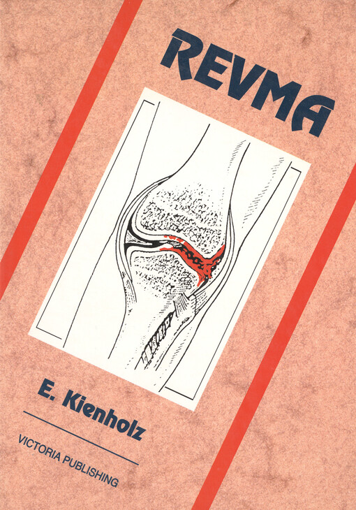 Revma: Odlišnosti klinického obrazu revmatických onemocnění : Způsoby léčby se zvláštním zřetelem na přírodní léčebné postupy a homeopatii