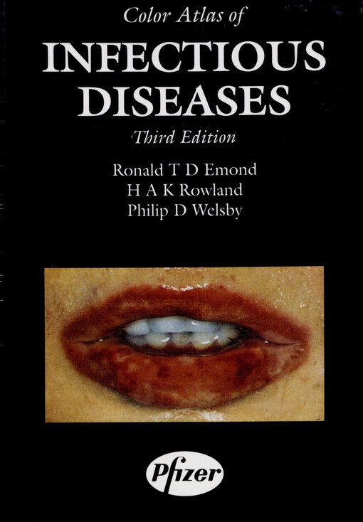Color atlas of infectious diseases