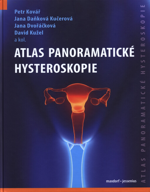 Atlas panoramatické hysteroskopie