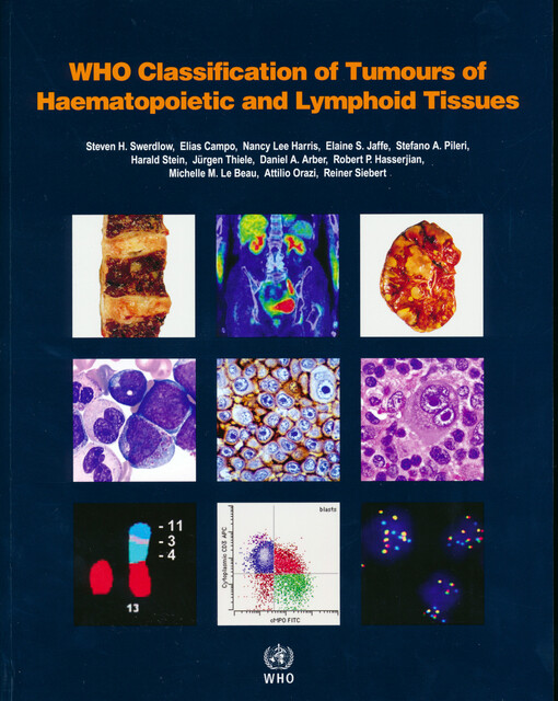 WHO classification of tumours of haematopoietic and lymphoid tissues