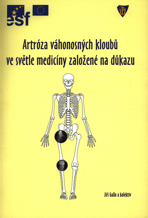 Artróza váhonosných kloubů ve světle medicíny založené na důkazu