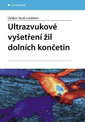 Ultrazvukové vyšetření žil dolních končetin | Musil Dalibor, kolektiv - e-kniha