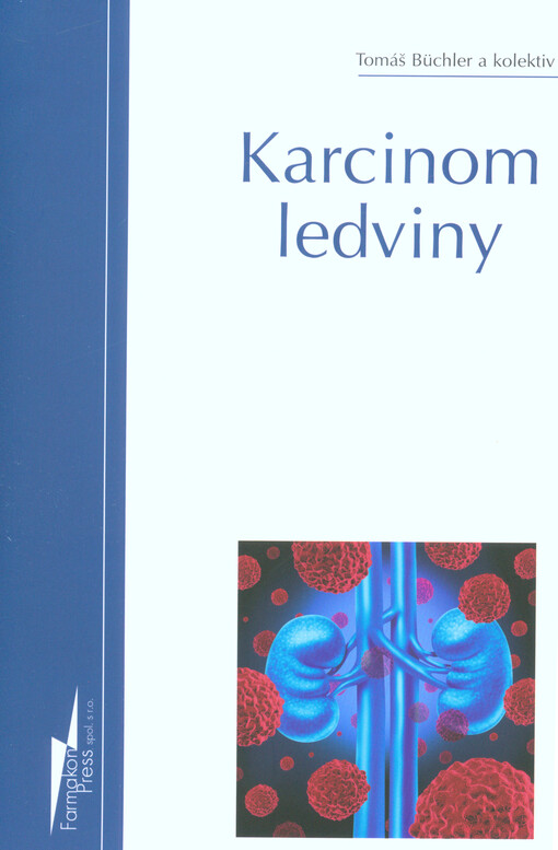 Karcinom ledviny