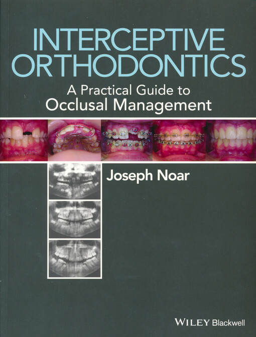 Interceptive orthodontics : a practical guide to occlusal management