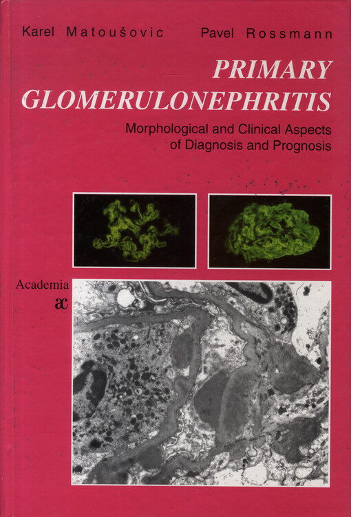 Primary Glomerulonephritis : morphological and clinical aspects of diagnosis and prognosis