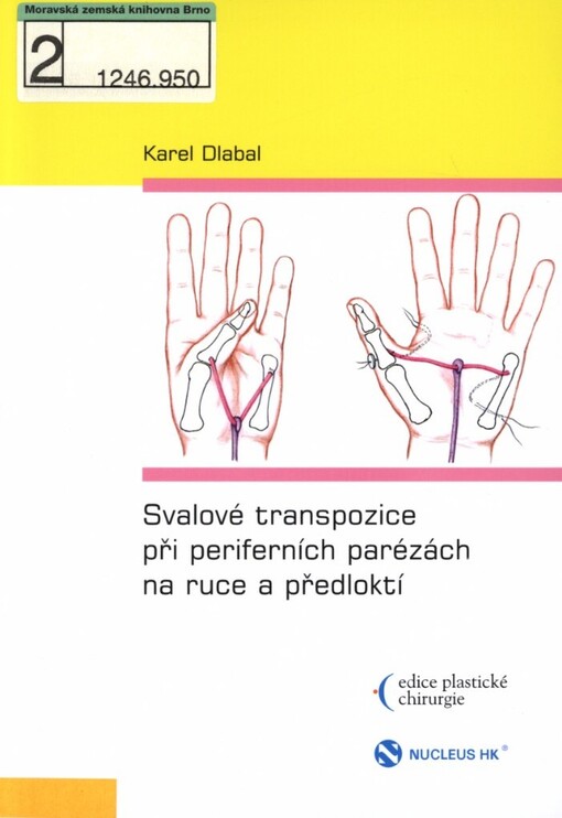Svalové transpozice při periferních parézách na ruce a předloktí