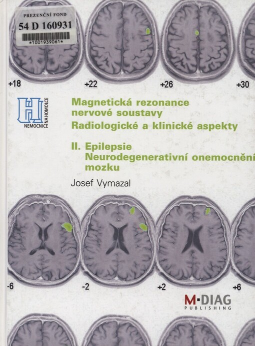 Magnetická rezonance nervové soustavy: radiologické a klinické aspekty, II., Epilepsie, neurodegenerativní onemocnění mozku