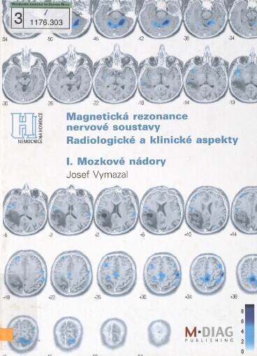 Magnetická rezonance nervové soustavy: radiologické a klinické aspekty