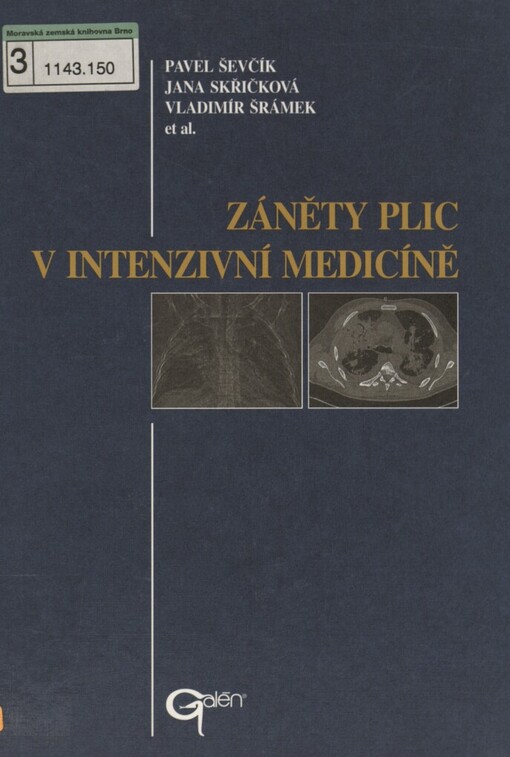 Záněty plic v intenzivní medicíně