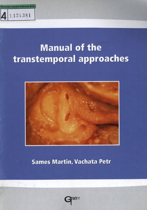 Manual of the transtemporal approaches