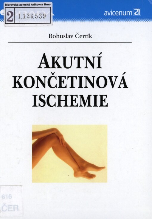 Akutní končetinová ischemie