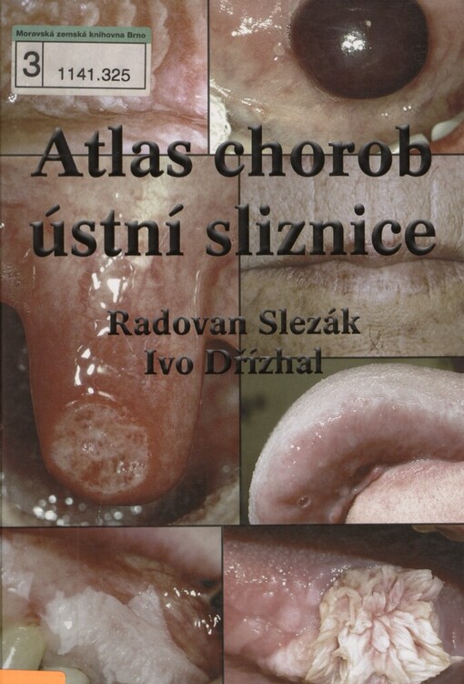 Atlas chorob ústní sliznice