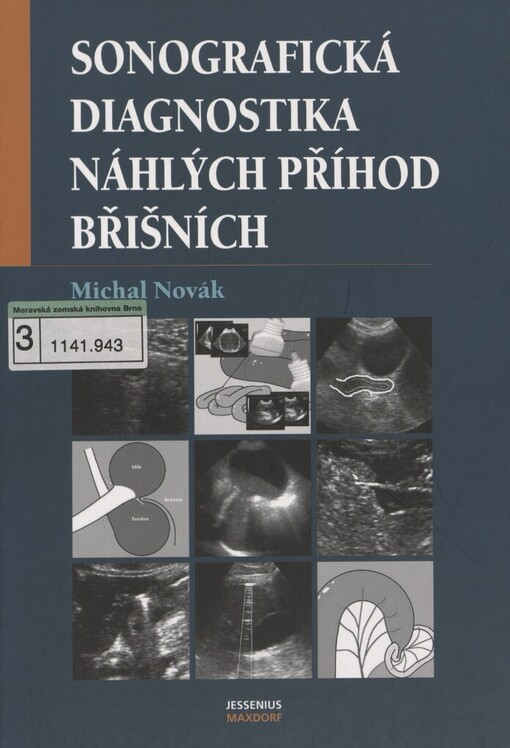 Sonografická diagnostika náhlých příhod břišních