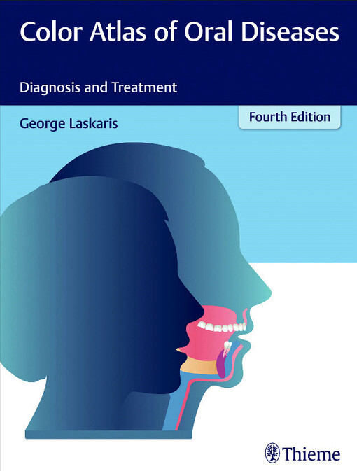 Color atlas of oral diseases diagnosis and treatment