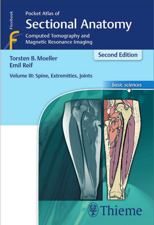 Pocket atlas of sectional anatomy computed tomography and magnetic resonance imaging. Volume III, Spine, extremities, joints