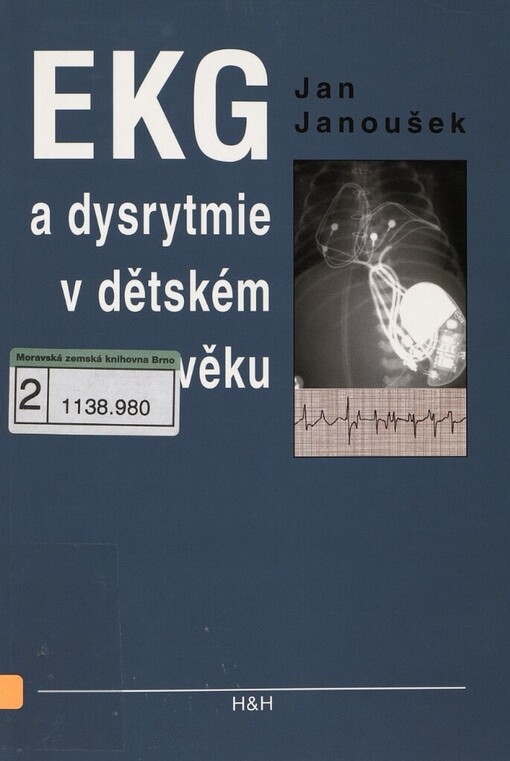 EKG a dysrytmie v dětském věku: praktický návod k diagnostice a léčbě
