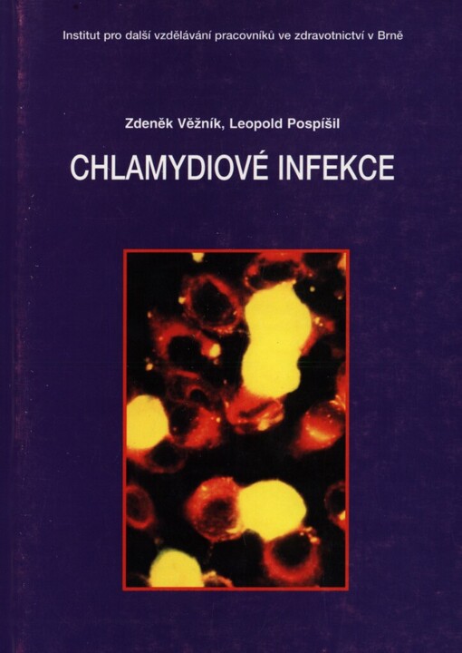 Chlamydiové infekce