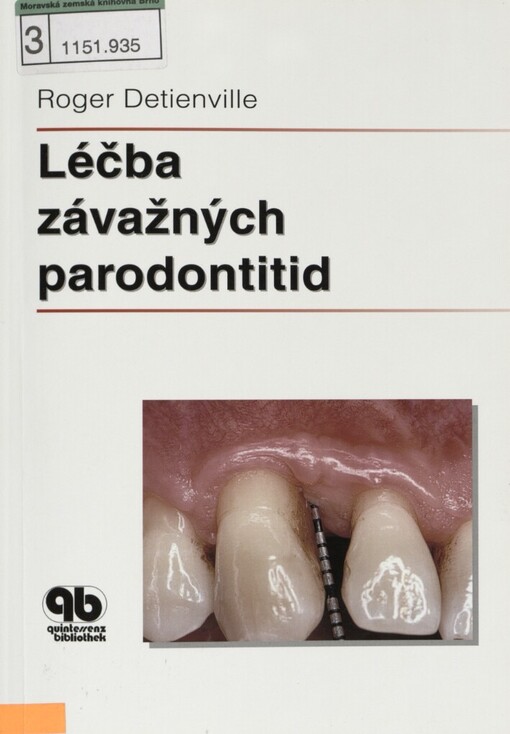 Léčba závažných parodontitid