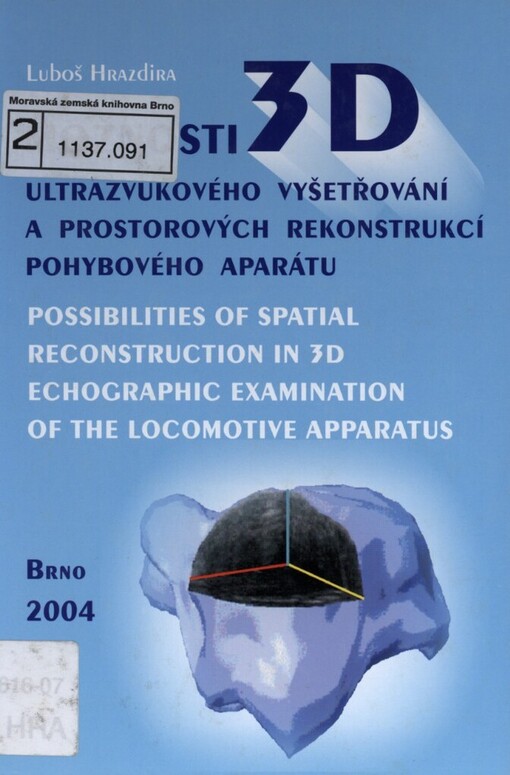 Možnosti 3D ultrazvukového vyšetřování a prostorových rekonstrukcí pohybového aparátu