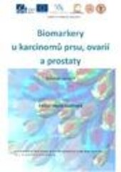 Biomarkery u karcinomů prsu, ovarií a prostaty
