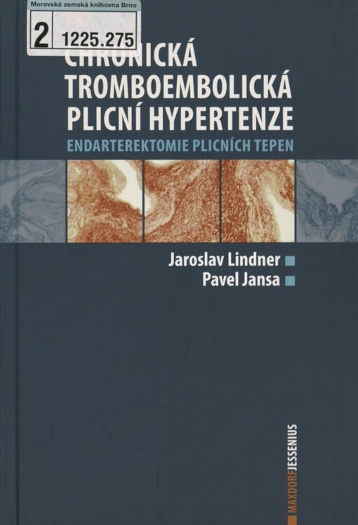 Chronická tromboembolická plicní hypertenze: endarterektomie plicních tepen