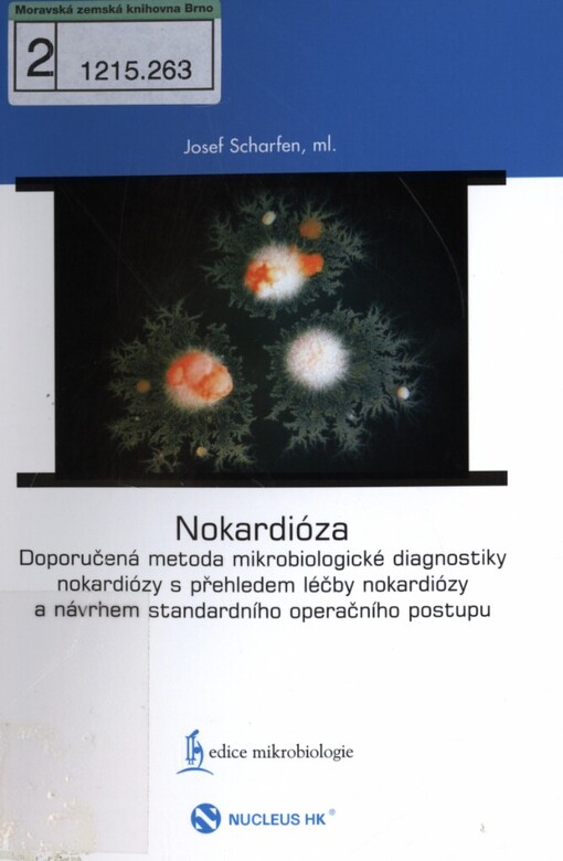 Nokardióza: doporučená metoda mikrobiologické diagnostiky nokardiózy s přehledem léčby nokardiózy a návrhem standardního operačního postupu