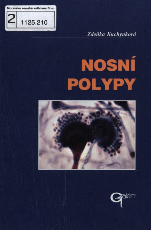 Nosní polypy