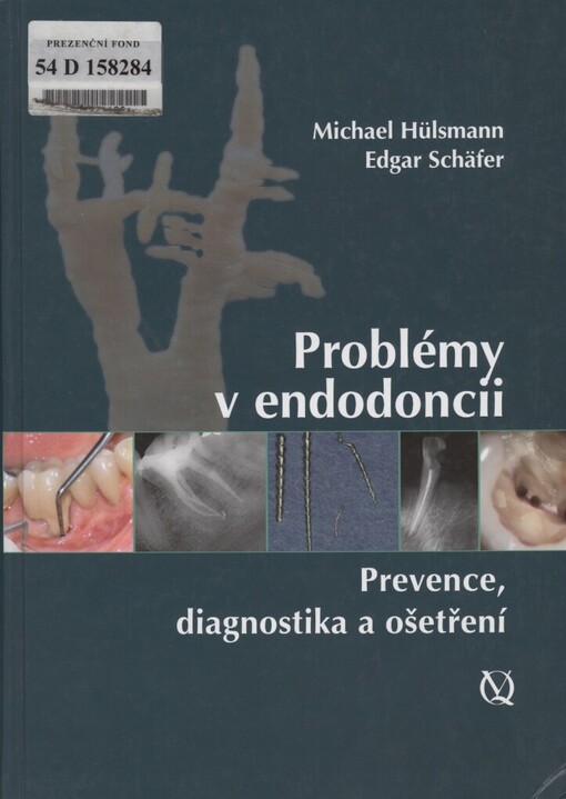 Problémy v endodoncii: prevence, diagnostika a ošetření