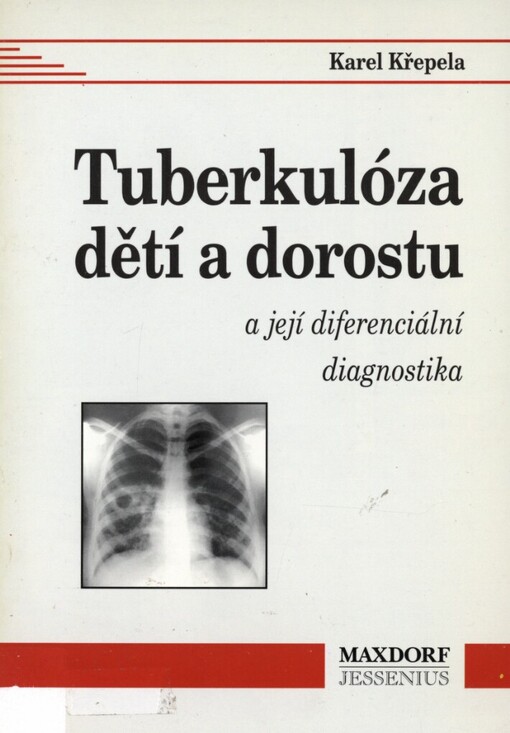 Tuberkulóza dětí a dorostu a její diferenciální diagnostika