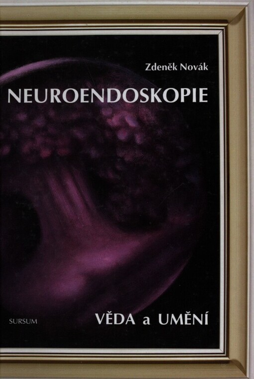 Neuroendoskopie :věda a umění