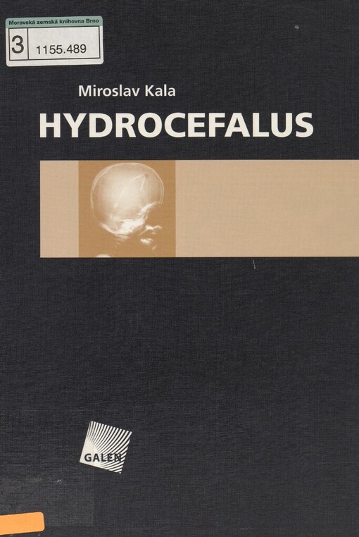 Hydrocefalus